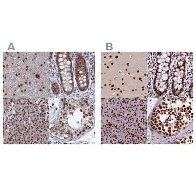 Immunohistochemistry-Paraffin: HRP-2 Antibody [NBP2-47437]