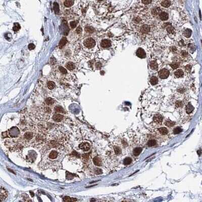 Immunohistochemistry-Paraffin: HRP-2 Antibody [NBP2-47437]