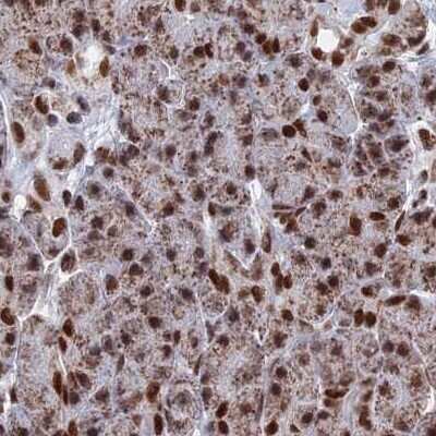 Immunohistochemistry-Paraffin: HRP-2 Antibody [NBP2-47437]
