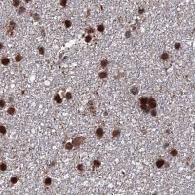 Immunohistochemistry-Paraffin: HRP-2 Antibody [NBP2-47437]