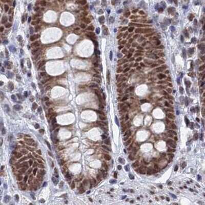 Immunohistochemistry-Paraffin: HRP-2 Antibody [NBP2-47437]