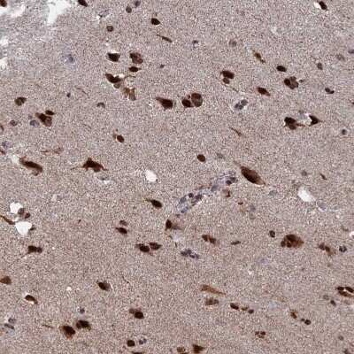 Immunohistochemistry-Paraffin: HRP-2 Antibody [NBP2-47437]
