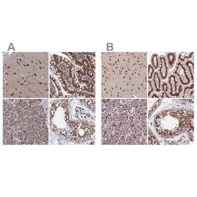 Immunohistochemistry-Paraffin: HRP-2 Antibody [NBP2-47437]