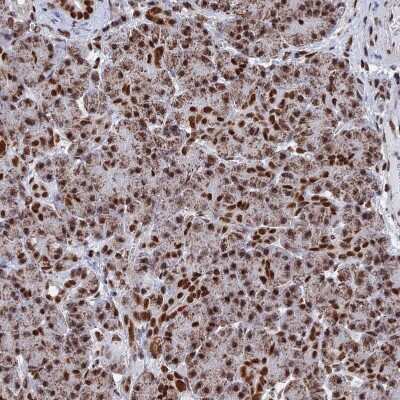 Immunohistochemistry-Paraffin: HRP-2 Antibody [NBP2-47437]