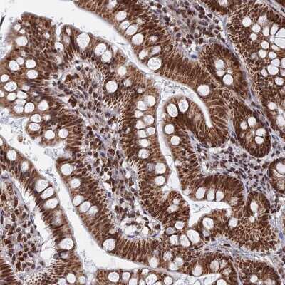 Immunohistochemistry-Paraffin: HRP-2 Antibody [NBP2-47437]