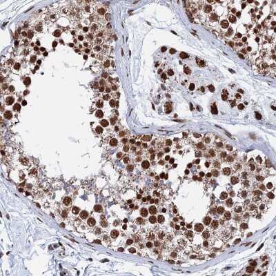 Immunohistochemistry-Paraffin: HRP-2 Antibody [NBP2-47437]