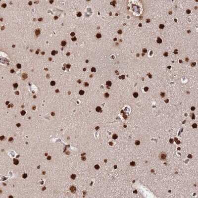Immunohistochemistry-Paraffin: HRP-2 Antibody [NBP2-47438]