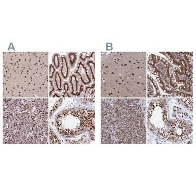 Immunohistochemistry-Paraffin: HRP-2 Antibody [NBP2-47438]