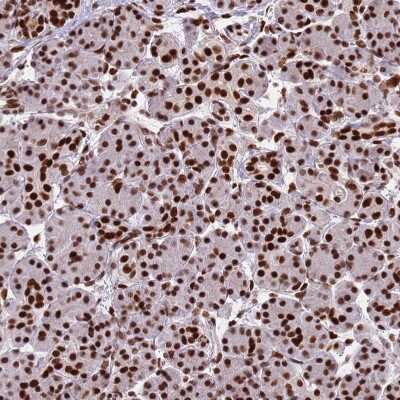 Immunohistochemistry-Paraffin: HRP-2 Antibody [NBP2-47438]