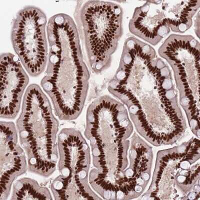 Immunohistochemistry-Paraffin: HRP-2 Antibody [NBP2-47438]