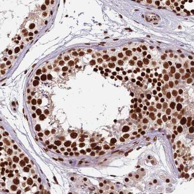 Immunohistochemistry-Paraffin: HRP-2 Antibody [NBP2-47438]