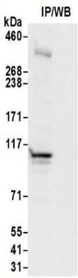 Immunoprecipitation: HRP-2 Antibody [NBP2-32069]