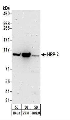 Western Blot: HRP-2 Antibody [NBP2-32074]