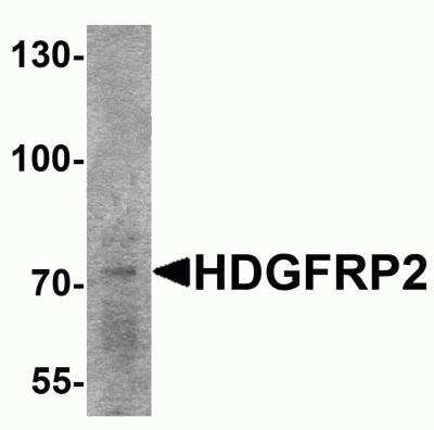 Western Blot: HRP-2 AntibodyBSA Free [NBP2-81994]