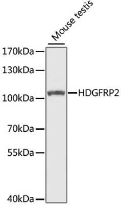 Western Blot: HRP-2 AntibodyBSA Free [NBP3-05607]