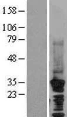 Western Blot: CDC73/HRPT2 Overexpression Lysate [NBL1-09015]