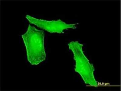 Immunocytochemistry/ Immunofluorescence: HRSP12 Antibody (2B8) [H00010247-M01]