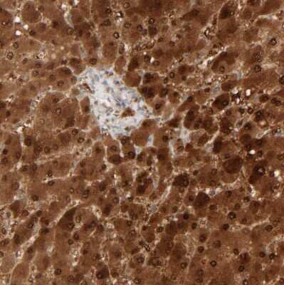 Immunohistochemistry: HRSP12 Antibody [NBP1-82453]