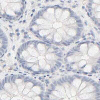 Immunohistochemistry-Paraffin: HRSP12 Antibody [NBP1-82453]