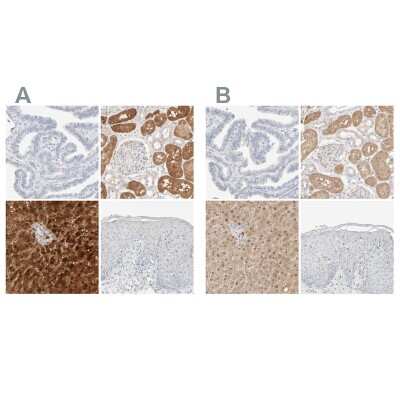 Immunohistochemistry-Paraffin: HRSP12 Antibody [NBP1-82453]