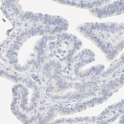 Immunohistochemistry-Paraffin: HRSP12 Antibody [NBP1-82453]
