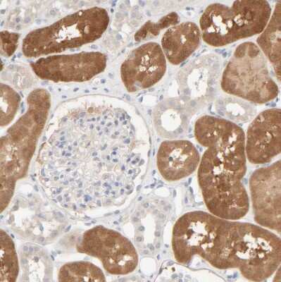 Immunohistochemistry-Paraffin: HRSP12 Antibody [NBP1-82453]