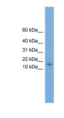 Western Blot: HRSP12 Antibody [NBP1-57084]