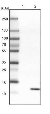 Western Blot: HRSP12 Antibody [NBP1-82453]