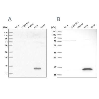 Western Blot: HRSP12 Antibody [NBP1-82453]