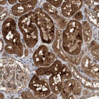 Immunohistochemistry-Paraffin: HS1BP3 Antibody [NBP1-83690]