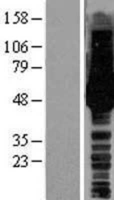 Western Blot: HS1BP3 Overexpression Lysate [NBL1-11711]