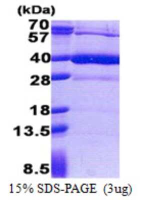 SDS-PAGE: Recombinant Human Heparan Sulfate 3-O-Sulfotransferase 1/HS3ST1 His Protein [NBP2-23116]