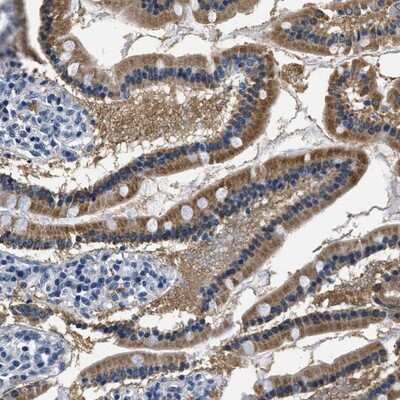 Immunohistochemistry-Paraffin: HS3ST2 Antibody [NBP1-89374]