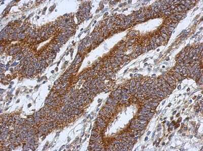 Immunohistochemistry-Paraffin: HS3ST2 Antibody [NBP2-16880]