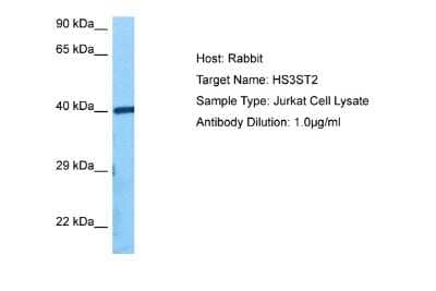 Western Blot: HS3ST2 Antibody [NBP2-87602]