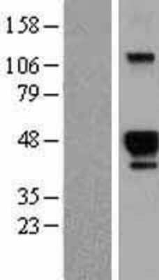 Western Blot: HS3ST2 Overexpression Lysate [NBL1-11714]