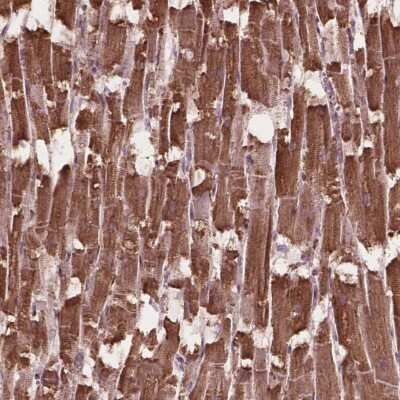 Immunohistochemistry: HS3ST3A1 Antibody [NBP2-49661]