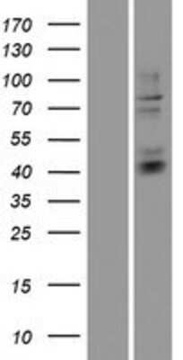 Western Blot: Heparan Sulfate Glucosamine 3-O-Sulfotransferase 3 Overexpression Lysate [NBP2-07681]