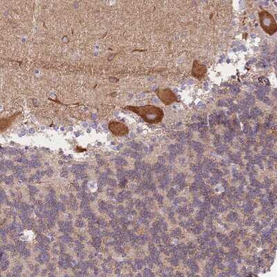 Immunohistochemistry-Paraffin: HS3ST5 Antibody [NBP2-55930]