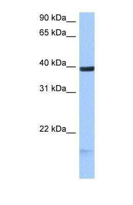 Western Blot: HS3ST5 Antibody [NBP1-69629]