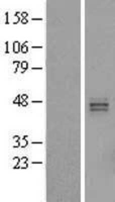 Western Blot: HS3ST5 Overexpression Lysate [NBL1-11715]