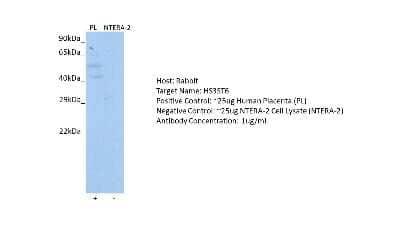 Western Blot: HS3ST6 Antibody [NBP1-91324]