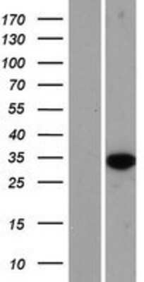 Western Blot: HS3ST6 Overexpression Lysate [NBP2-08707]