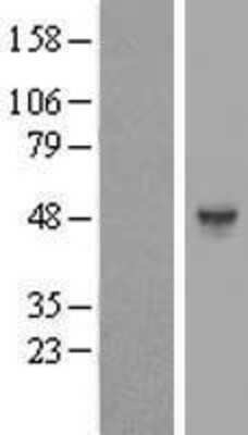 Western Blot: Heparan Sulfate 6-O-Sulfotransferase 1/HS6ST1 Overexpression Lysate [NBP2-07824]