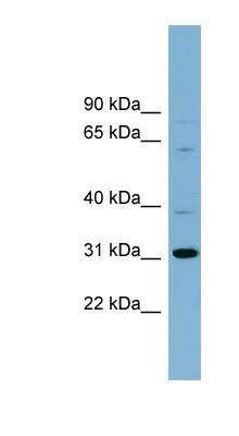 Western Blot: HS747E2A Antibody [NBP1-79705]