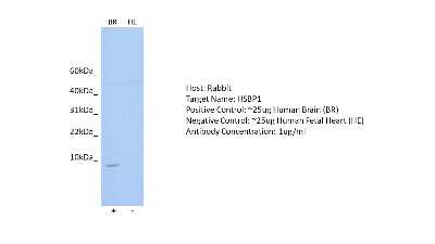 Western Blot: HSBP1 Antibody [NBP2-84079]