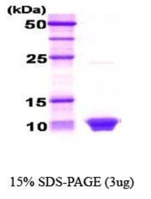 SDS-PAGE: Recombinant Human HSBP1 Protein [NBC1-18355]