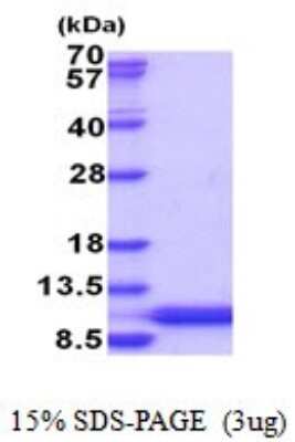 SDS-PAGE: Recombinant Human HSBP1L1 His Protein [NBP2-51861]