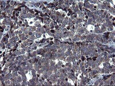 Immunohistochemistry-Paraffin: HSCB Antibody (OTI3E1) [NBP2-46506]