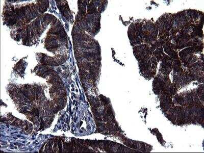 Immunohistochemistry-Paraffin: HSCB Antibody (OTI3E1) [NBP2-46506]